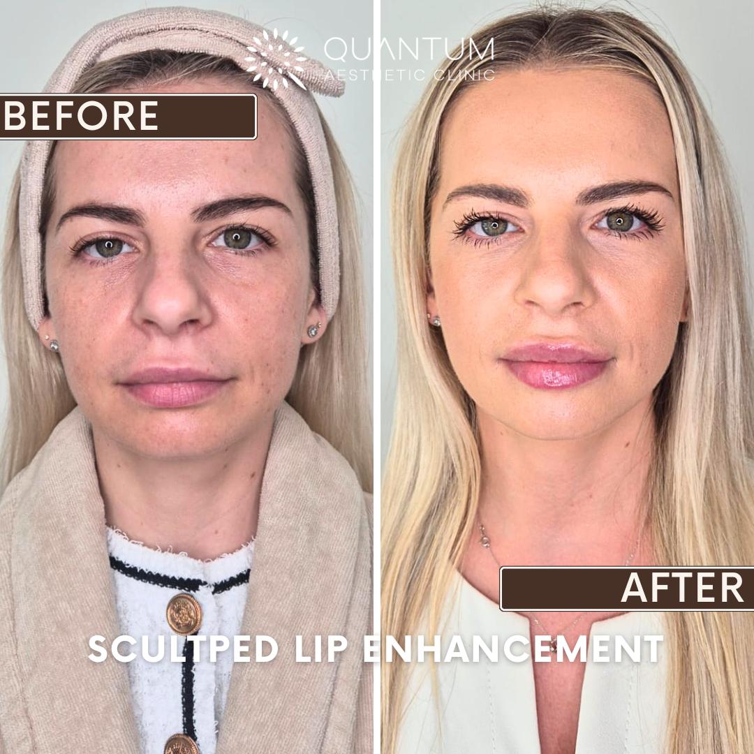 Before and after results
